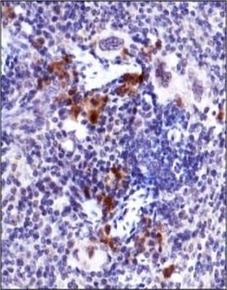 ATM Antibody (10H11.E12) - Azide and BSA Free, Novus Biologicals 0.1 mL;